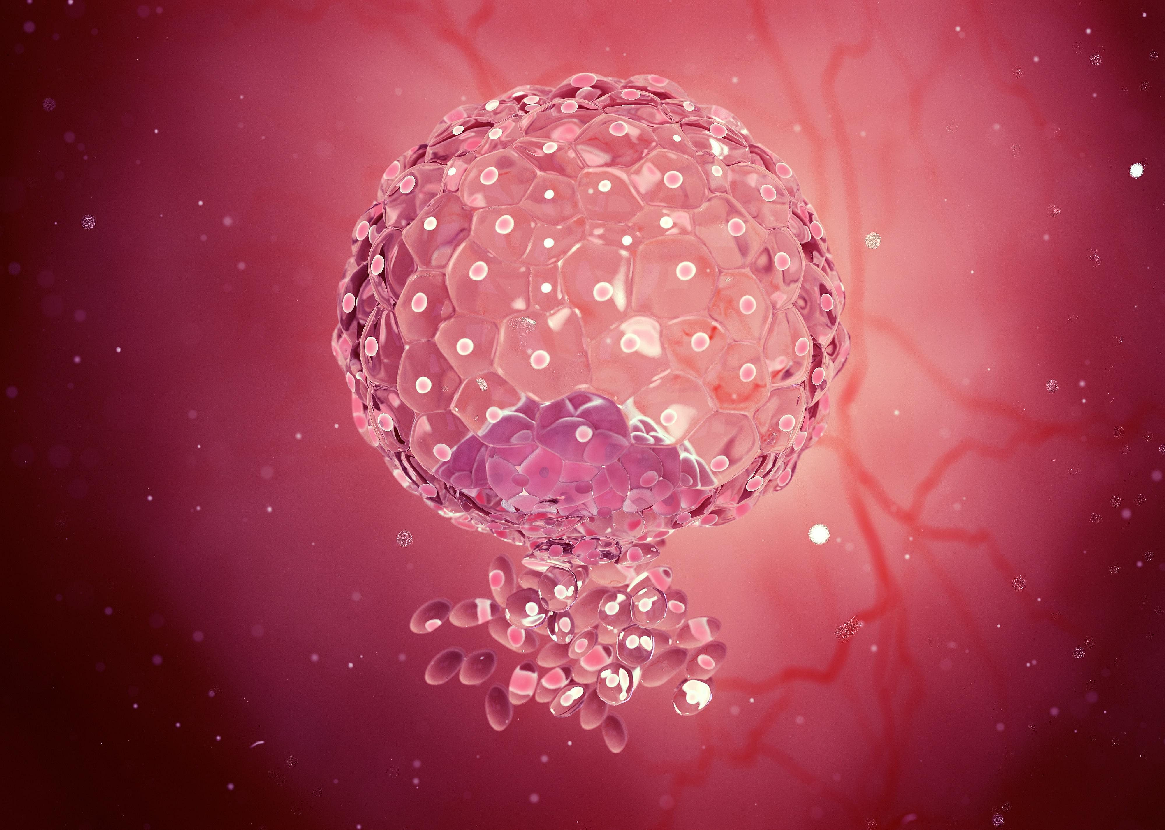 #4. Implantation