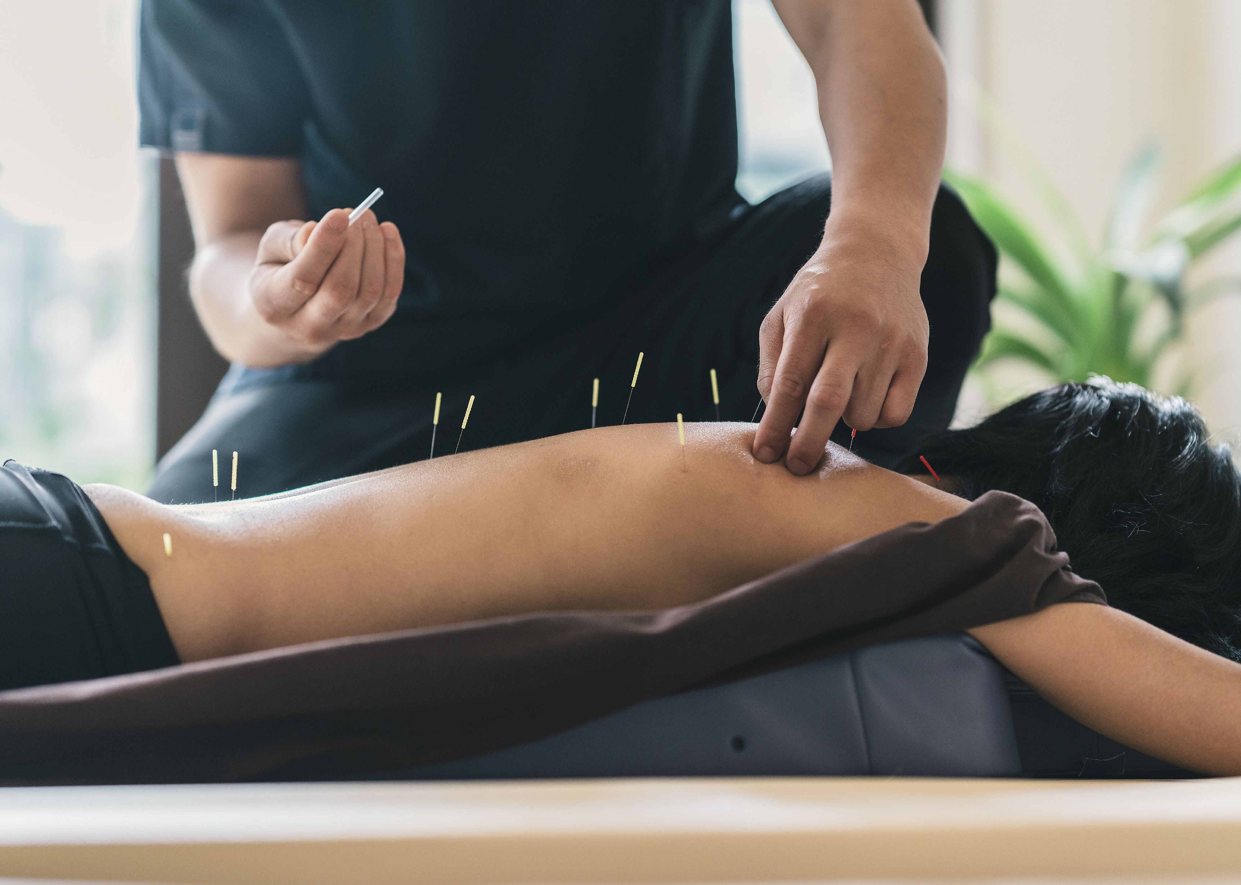 #41. Acupuncturists