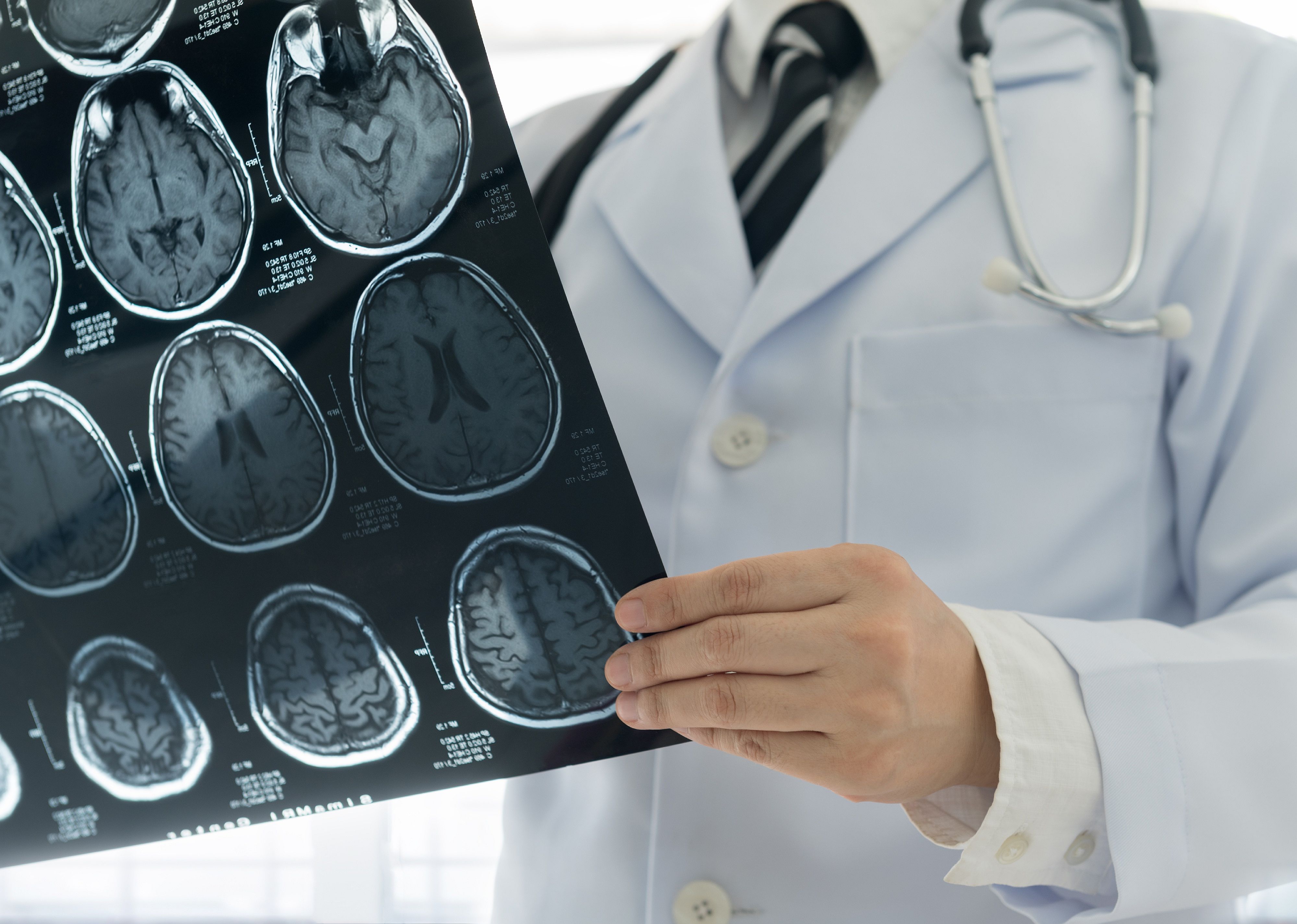 #1. Neurologists (tie)