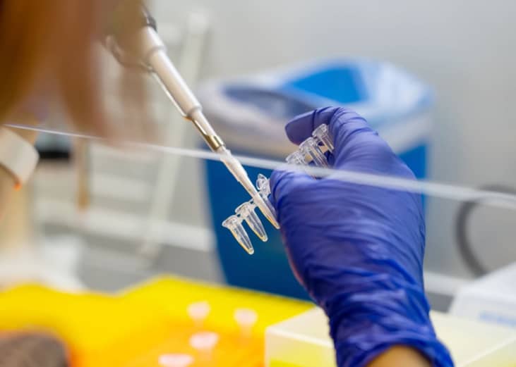 A worker's hand uses a pipette to test sampoles in a lab