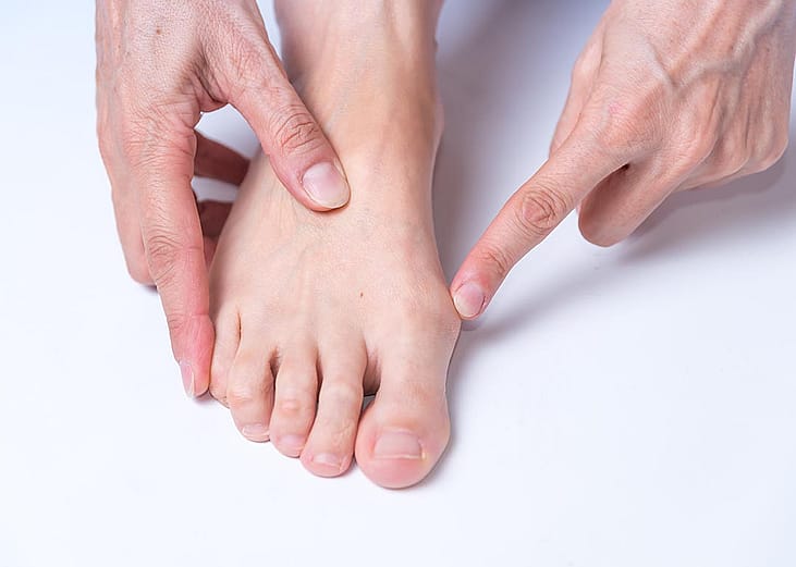 Top down view of light skinned person pointing to the bunion on their right foot.