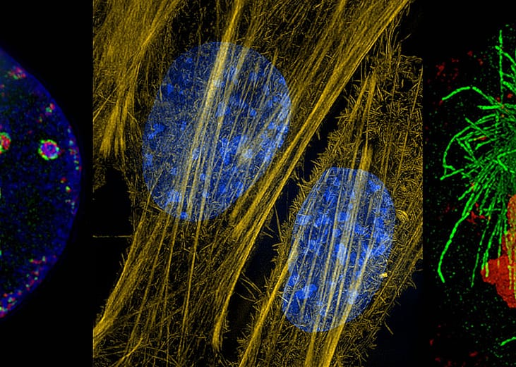 Composite of three mages from new microscope technology show a cell's replication machinery in green, already-replicated DNA is red and DNA bundled into chromatin in blue. At center, the cytoskeleton’s actin fibers in mouse connective tissue cells are seen in yellow; cellular DNA is stained blue. At right is a human cell dividing in two with its genetic material labeled in red, and the spindle apparatus that pulls the sister chromatids apart labeled in green.