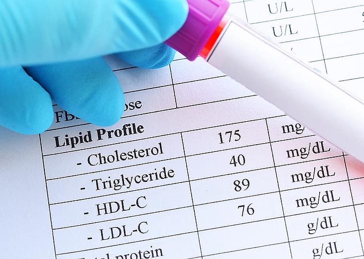 A blood sample in a test tube tube held in front of a printout of lipid profile test results. 