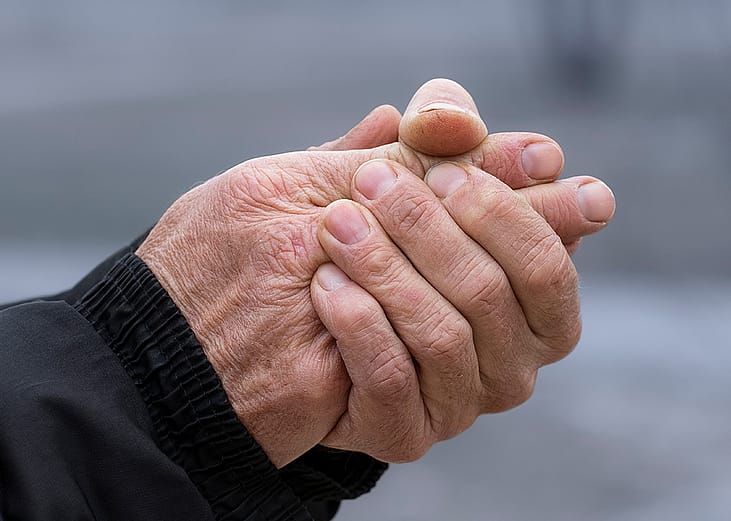 A senior person's hands drying out due to cold weather.