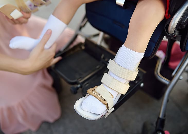 A mother helps her disabled daughter with putting on leg braces.