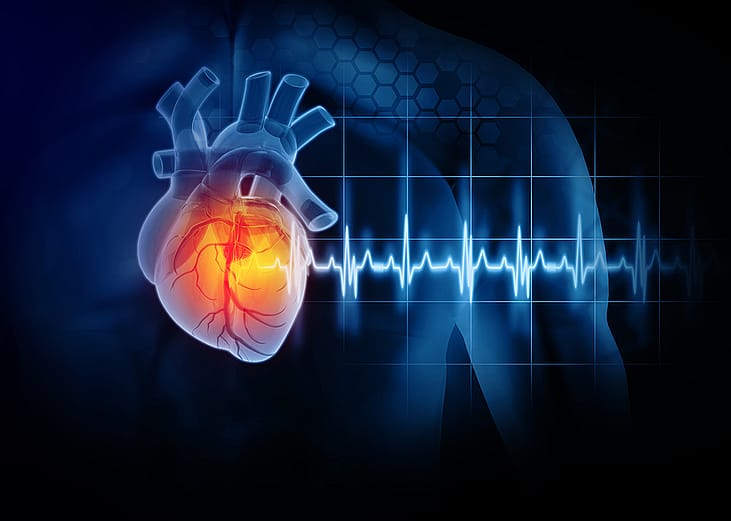 A 3D illustration of a heart attack disease. 