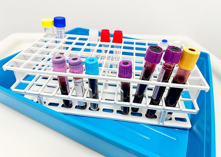 Blood test vials arranged in a test tube rack.