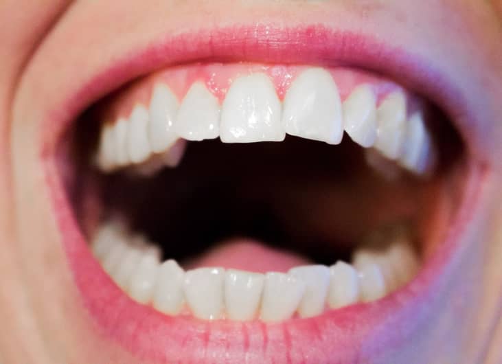 #32. August 6: Fresh Breath Day
