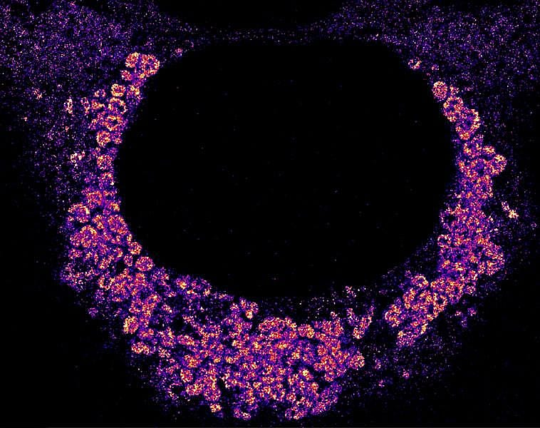 Image of how the Covid-19 virus hides from the cell’s immune system by wrapping itself inside double-membrane bubbles when replicating. The bubbles are seen as clumpy aggregates of the virus’s fluorescently labeled genetic material and the dark circle in the middle is the cell nucleus.