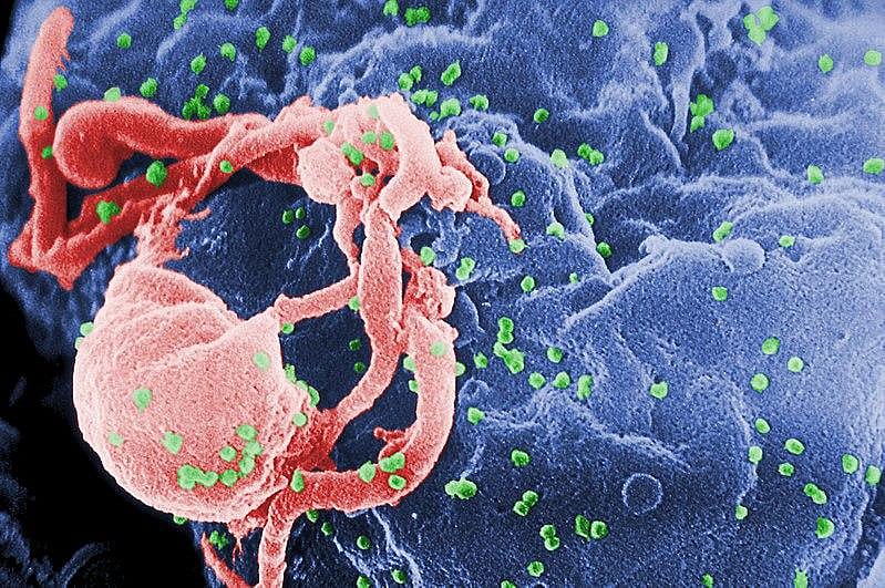 #18. HIV/AIDS