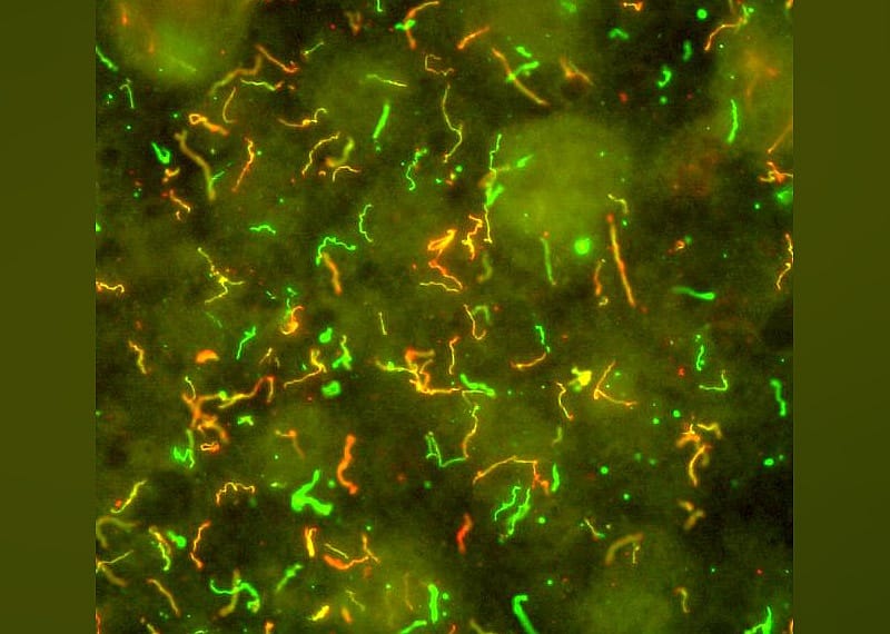 1998: Lyme vaccine approved