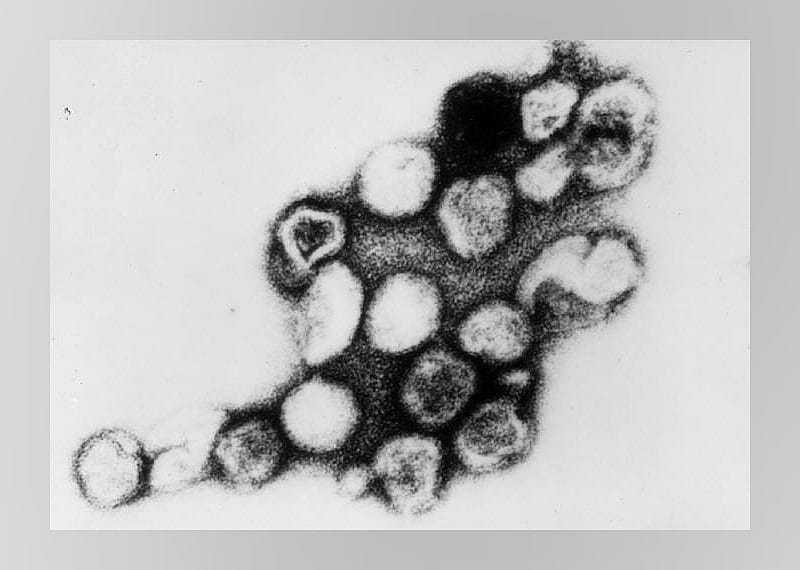 1941: Rubella implicated in birth defects