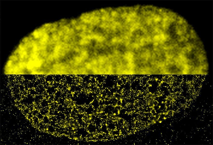 A composite of two images shows technological advances: the top half was imaged with conventional wide-field fluorescence microscopy; the bottom half was imaged with super-resolution microscopy.  Within a fibroblast cell nucleus, the DNA-binding histone protein called H2B is fluorescently labeled in yellow. 