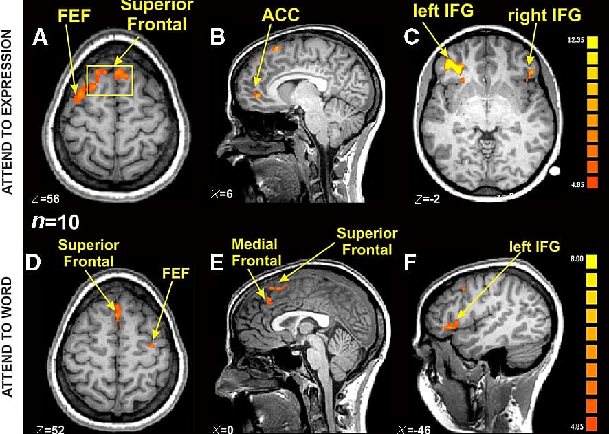 1991: fMRI introduced