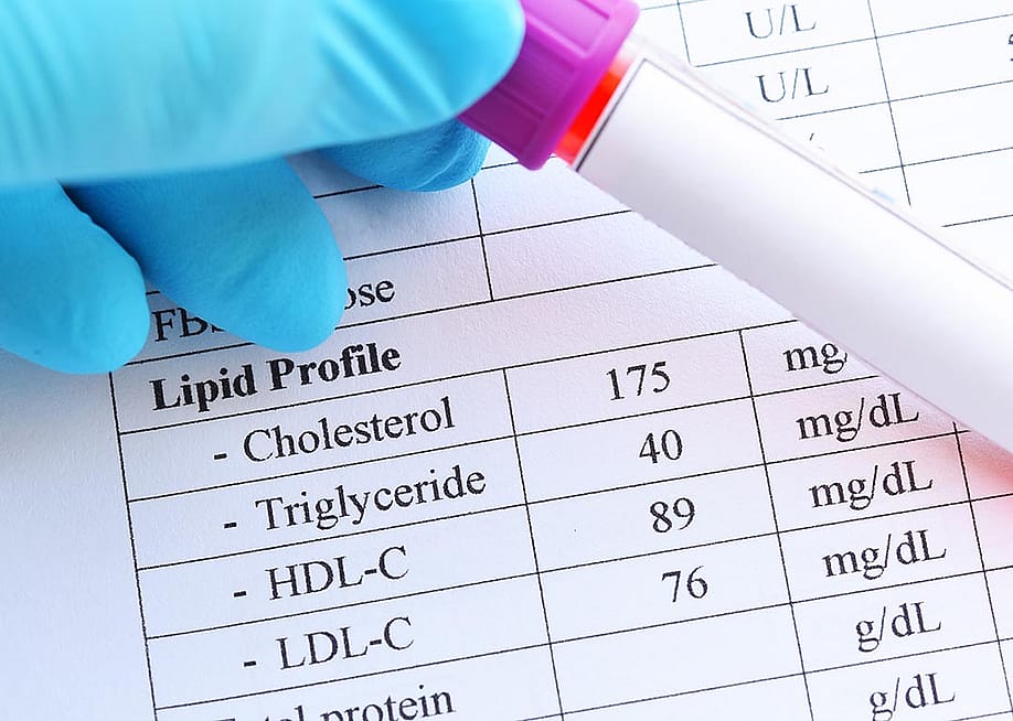 A blood sample in a test tube tube held in front of a printout of lipid profile test results. — Jarun Ontakrai // Shutterstock