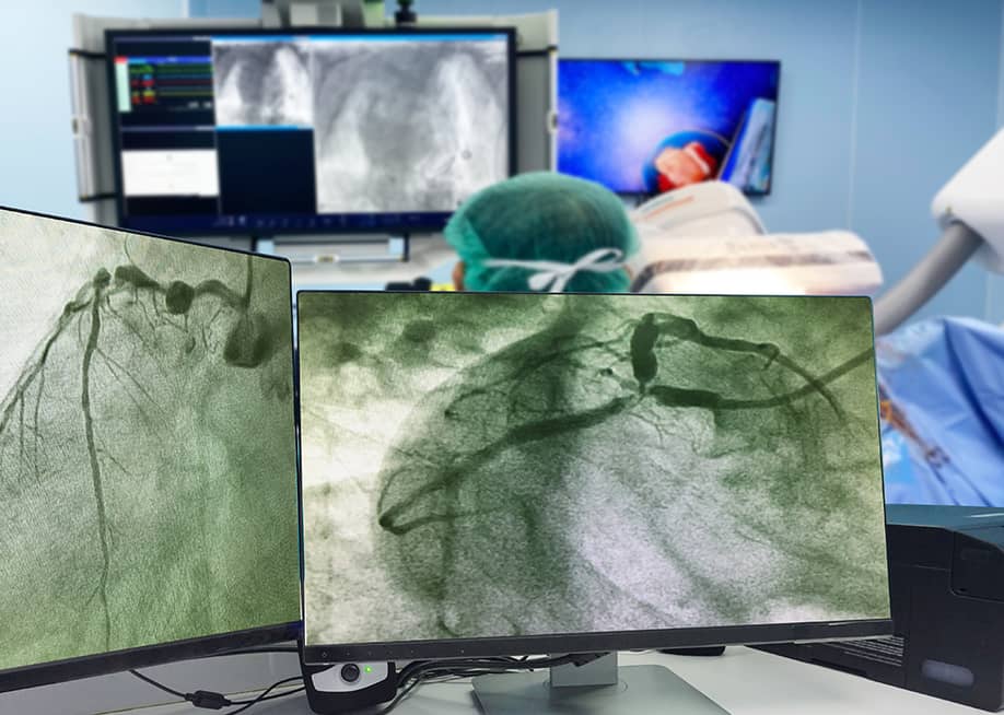 Monitors showing results of a coronary angiogram with doctors and a patient behind it. — April stock // Shutterstock
