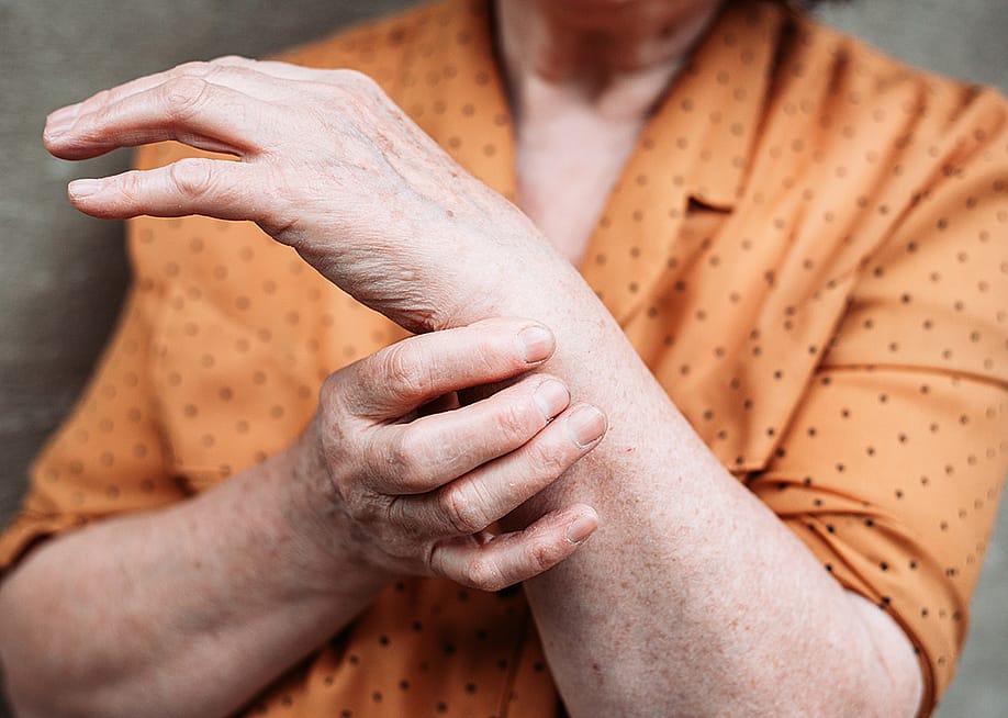 An elderly woman's hands experiencing pains. — Stivog // Shutterstock