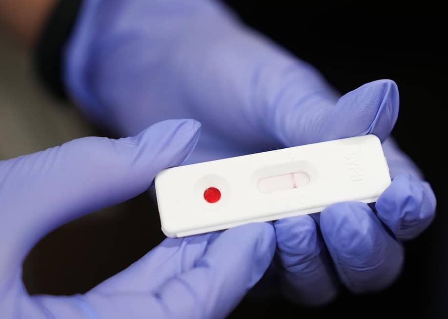 Dr. Ana Davie shows what a negative test for congenital syphilis looks like in just ten minutes at Memorial Hermann - TMC on Wednesday, June 12, 2024 in Houston. — Elizabeth Conley // Houston Chronicle via Getty Images