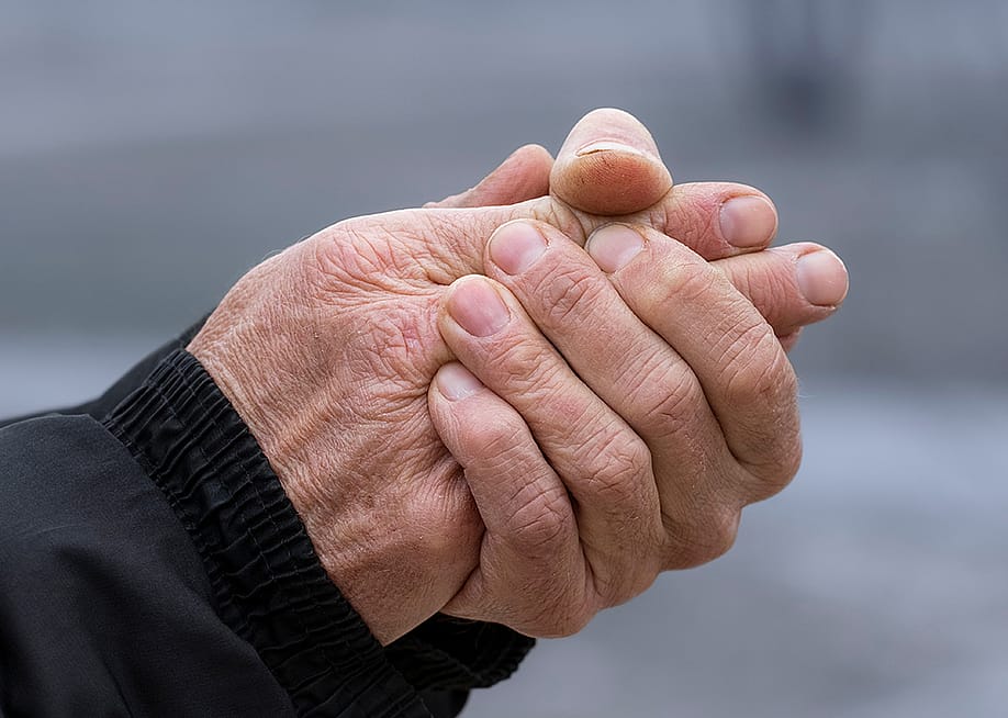 A senior person's hands drying out due to cold weather. — movchanzemtsova // Shutterstock