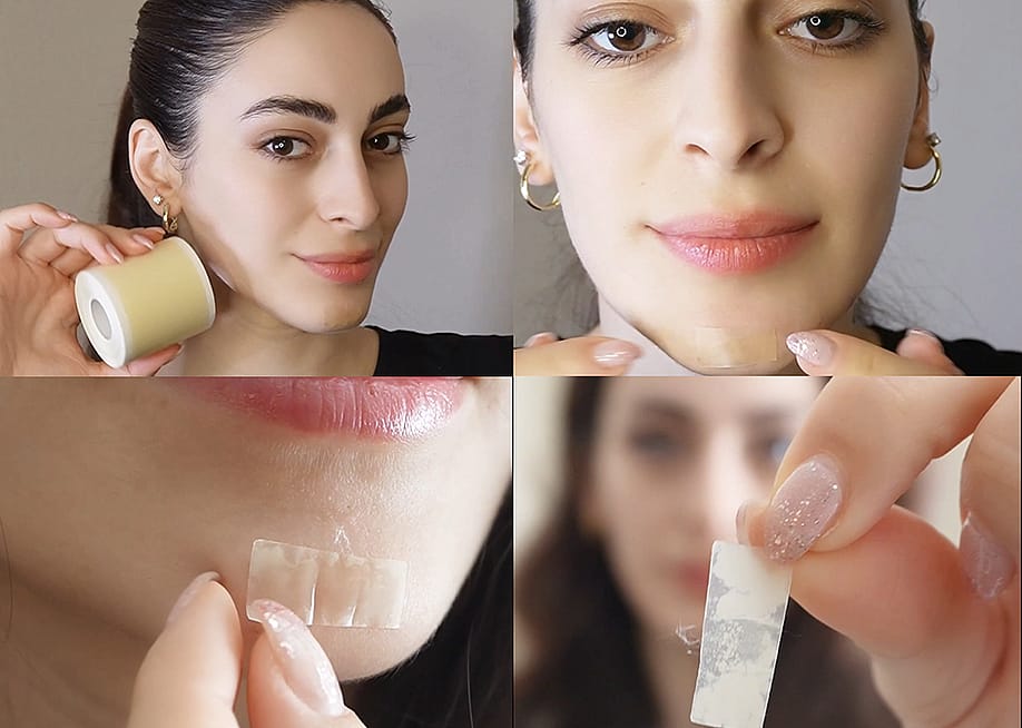 A composite image of a woman trying a hydrocolloid patch on her face. — Photos courtesy of Dimora Medical