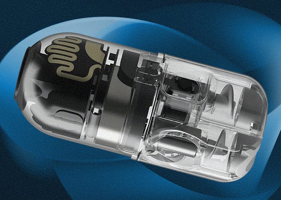 An ingestible robot that moves within the stomach using pump-jet motors would enable clinicians to control a gastric exam in real time without the cost and complexity of traditional endoscopy. — Courtesy of Endiatx