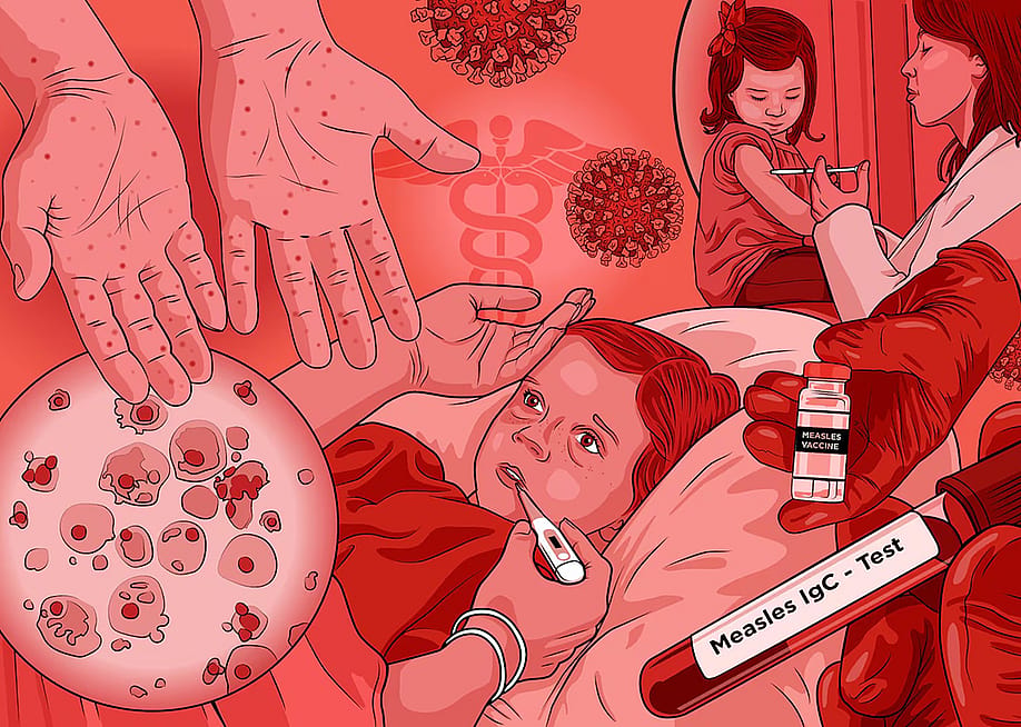 A custom illustration featuring children surrounded by graphics of the Michigan measles outbreak. — Hiram Henriquez for Healthbeat