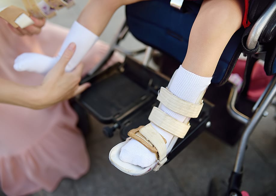 A mother helps her disabled daughter with putting on leg braces. — Maria Sbytova // Shutterstock