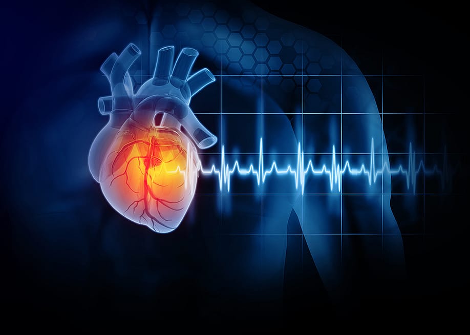 A 3D illustration of a heart attack disease. — crystal light // Shutterstock