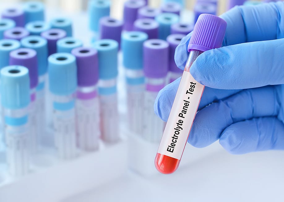 A blood sample tube with an electrolyte panel test label. — StanislavSukhin // Shutterstock