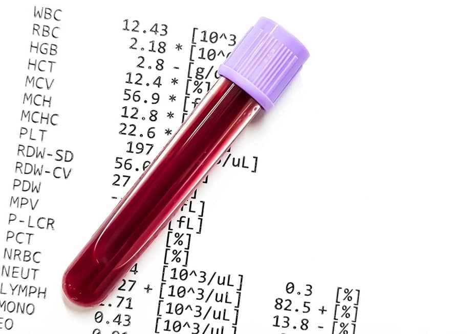 A blood sample in a collection tube and a complete blood count (CBC) report underneath. — Saiful52 // Shutterstock