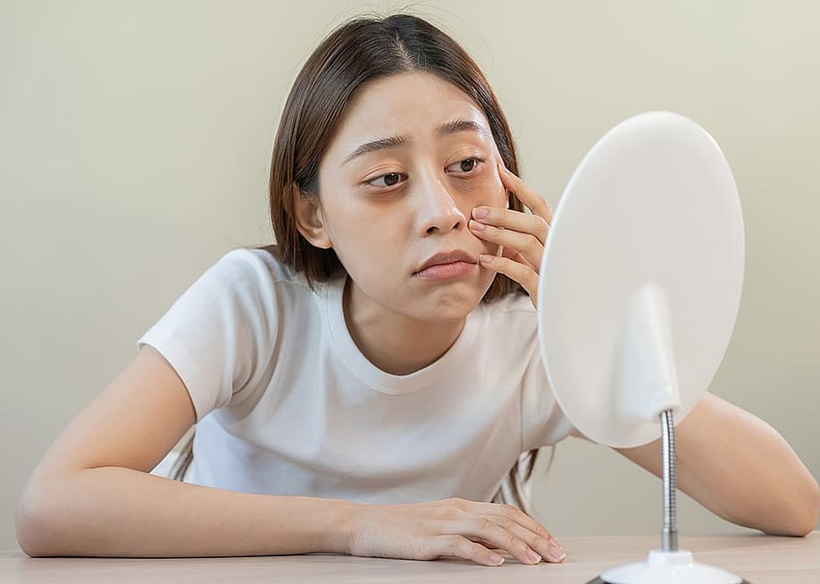 A young woman checking her dark under eyes in front of a mirror. — Kmpzzz // Shutterstock